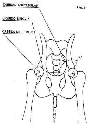 CoAcetabulo.jpg (21102 bytes)